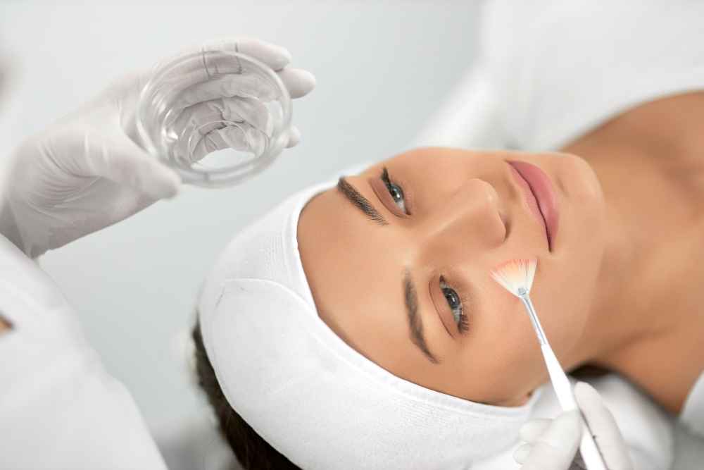 peeling-chimic peeling chimic